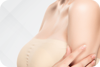 Breast Augmentation