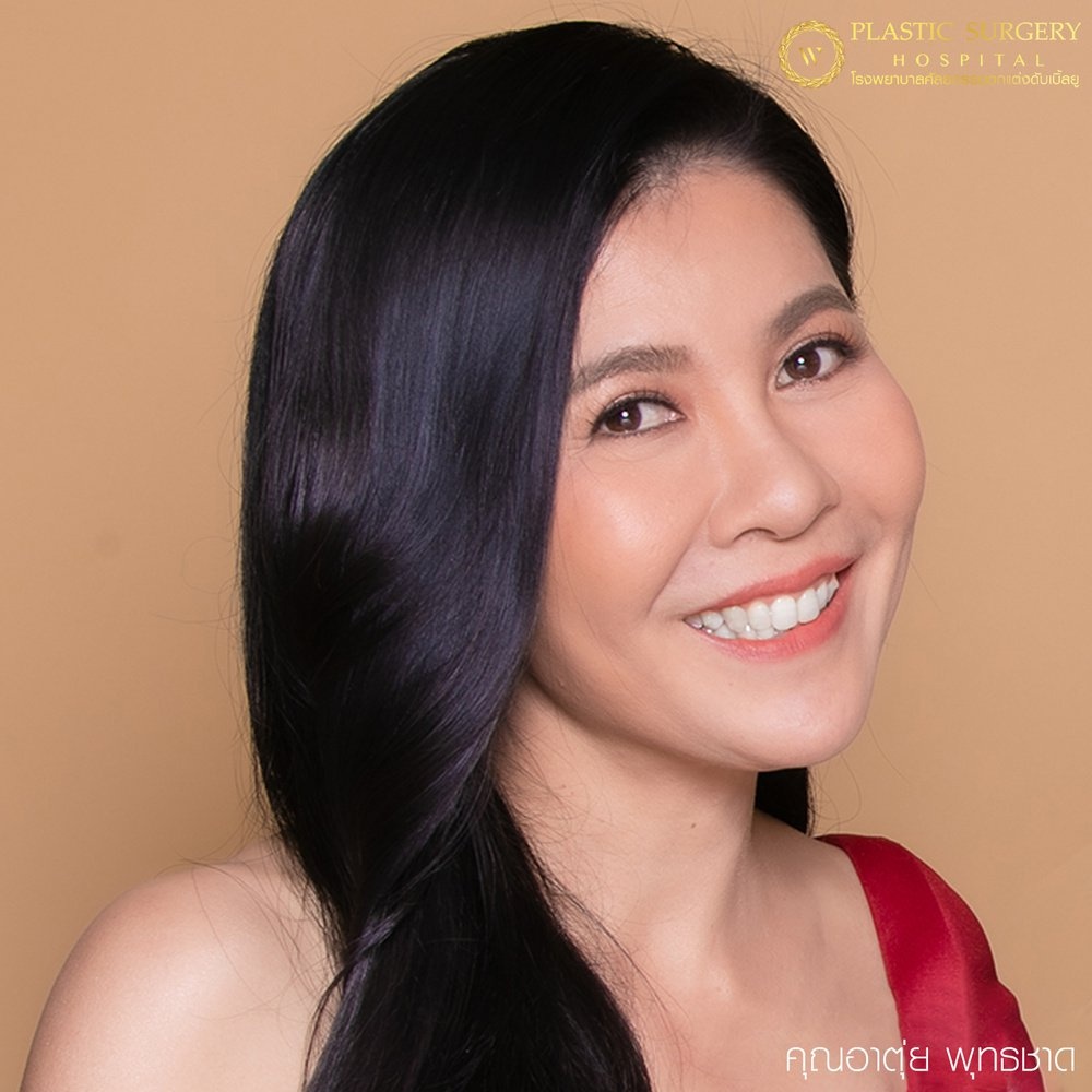 หนังตา/หางตาบนตก