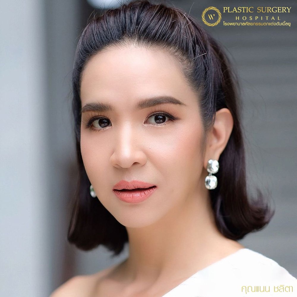 หนังตา/หางตาบนตก