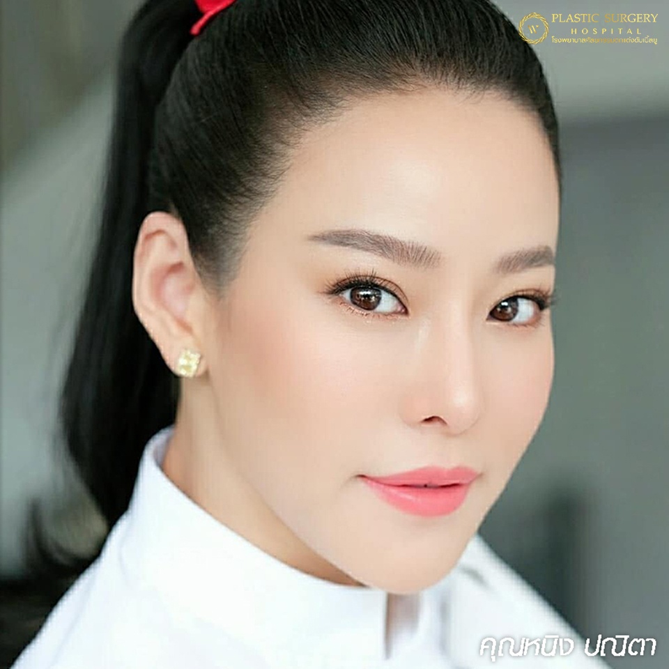 หนังตา/หางตาบนตก