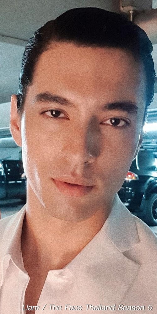 เสริมจมูก