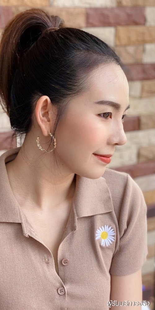 เสริมจมูก