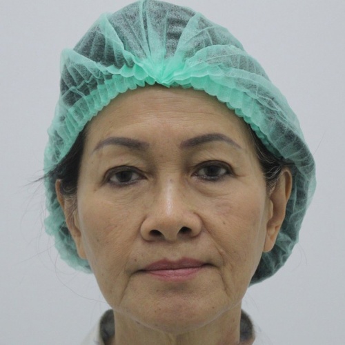 ดึงหน้า