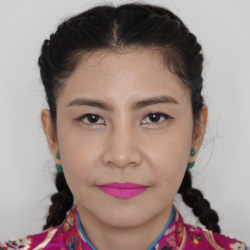 ดูดไขมันเหนียงใต้คาง (FaceTite)