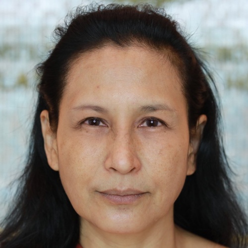 ดึงหน้า