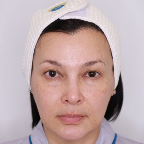 ดึงหน้า