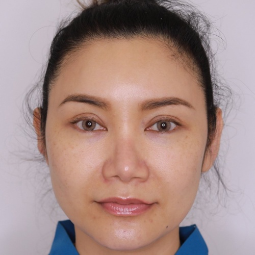 ดึงหน้า