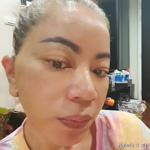 ดึงหน้า