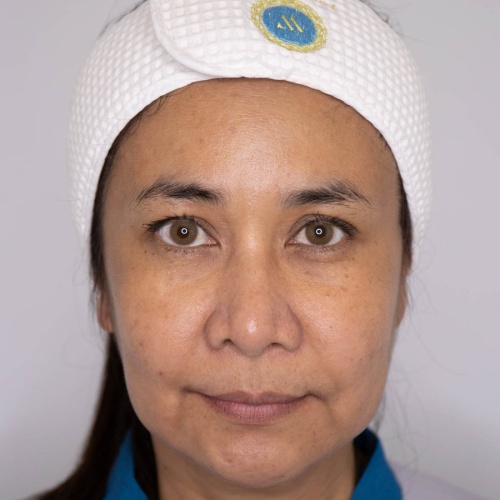 ดึงหน้า