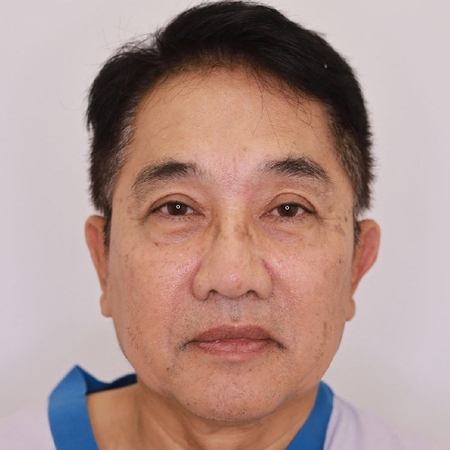 ดึงหน้า