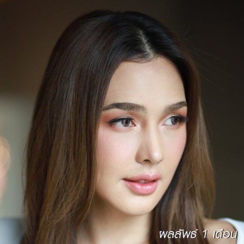 เสริมจมูก