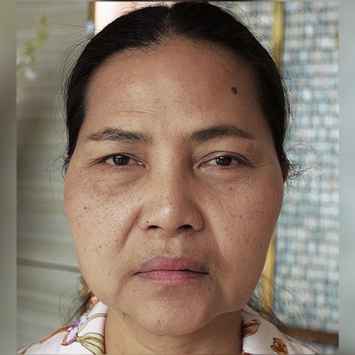 ดึงหน้า