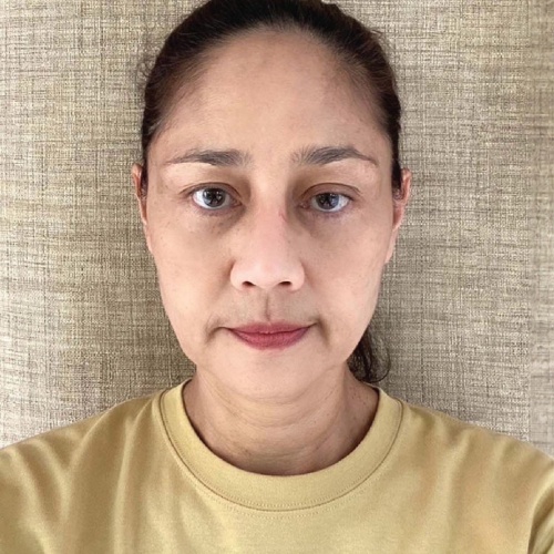 ดึงหน้า