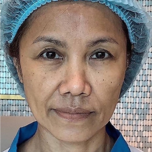 ดึงหน้า