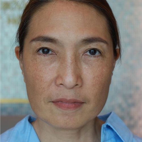 ดึงหน้า