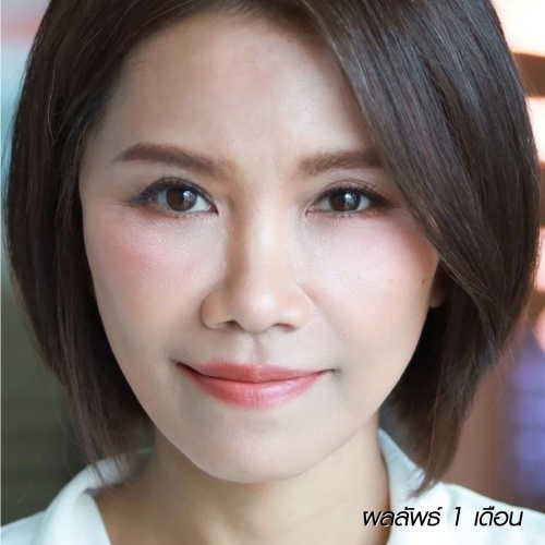 ดึงหน้า