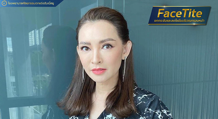 หลังทำ facetite