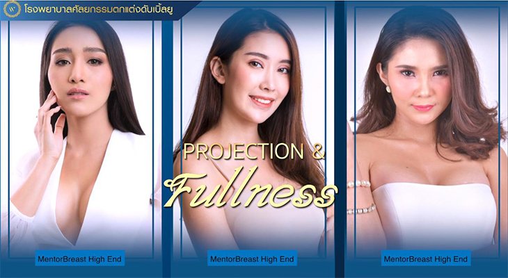 เลือกซิลิโคน “MenterBreast High End” เพื่อหน้าอกที่สวยงามสมบูรณ์แบบ เสริมสร้างความมั่นใจให้สรีระสมส่วน